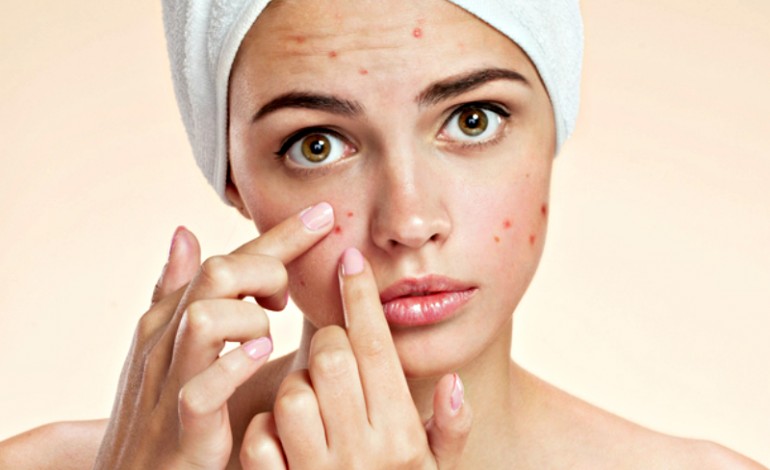 Cómo eliminar las manchas del acné