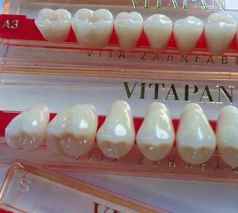 Cómo lucir implantes dentales de titanio