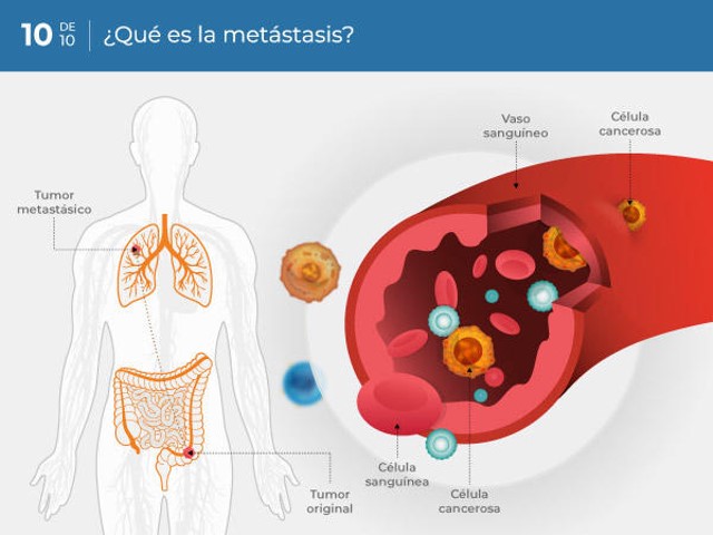 El cáncer y sus recetas