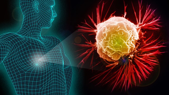 cáncer