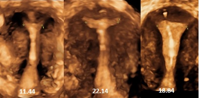 Figure5-ultrasound