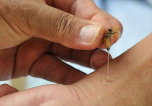 Cómo tratar la picadura de abejaa