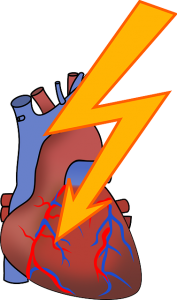 Cómo tratar y qué es la arritmia cardíaca