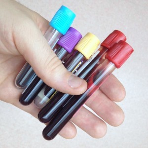 Cómo interpretar un análisis de sangre