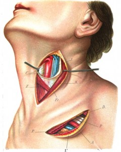 Cuáles son los síntomas del hipotiroidismo