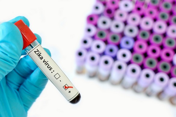 Virus Zika