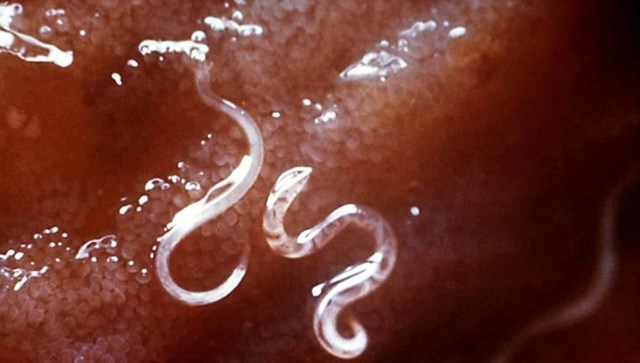 Parásitos intestinales