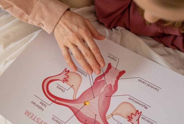 Cómo eliminar un mioma uterino de forma natural